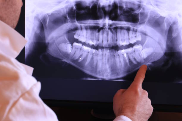 Best Emergency Treatment for Toothache in Beechwood, MS