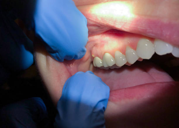 Best Emergency Dental Care for Trauma or Injury in Beechwood, MS